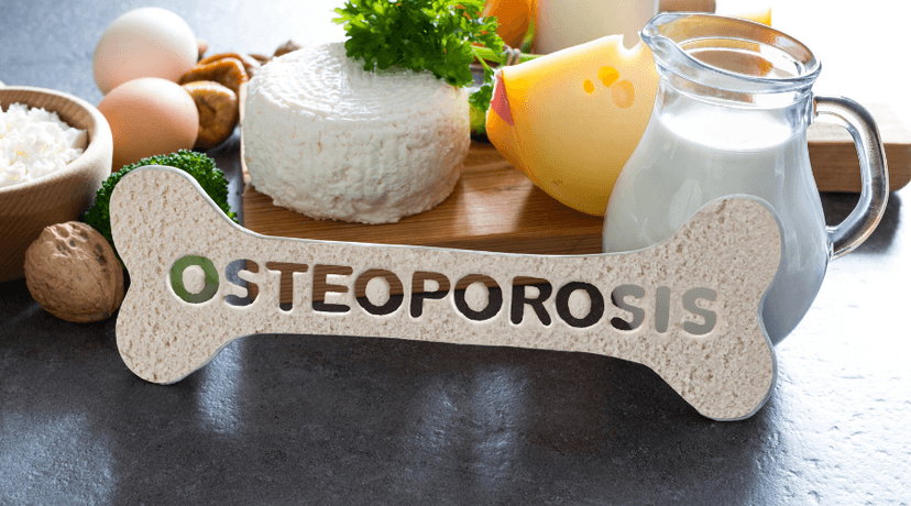 Osteoporose: Visão da Nutrição Funcional